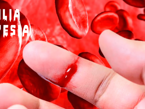 Hemofilia y anestesia